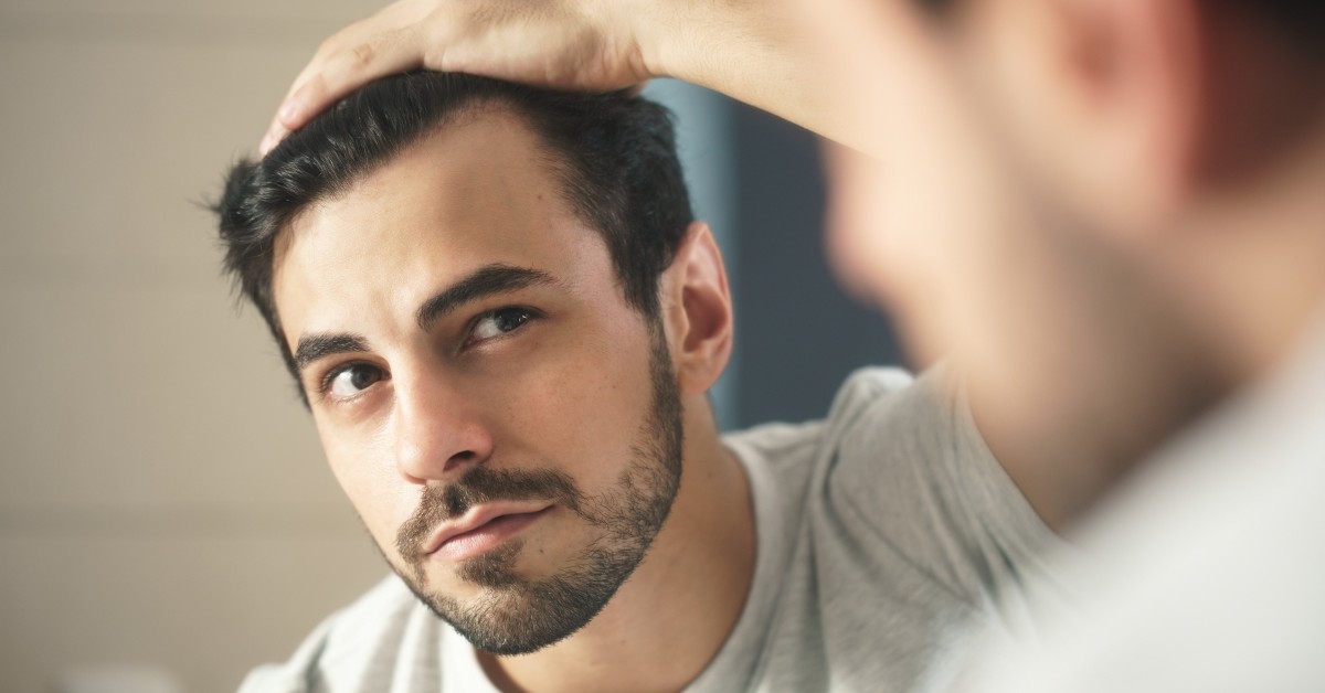 Combating hair loss in men