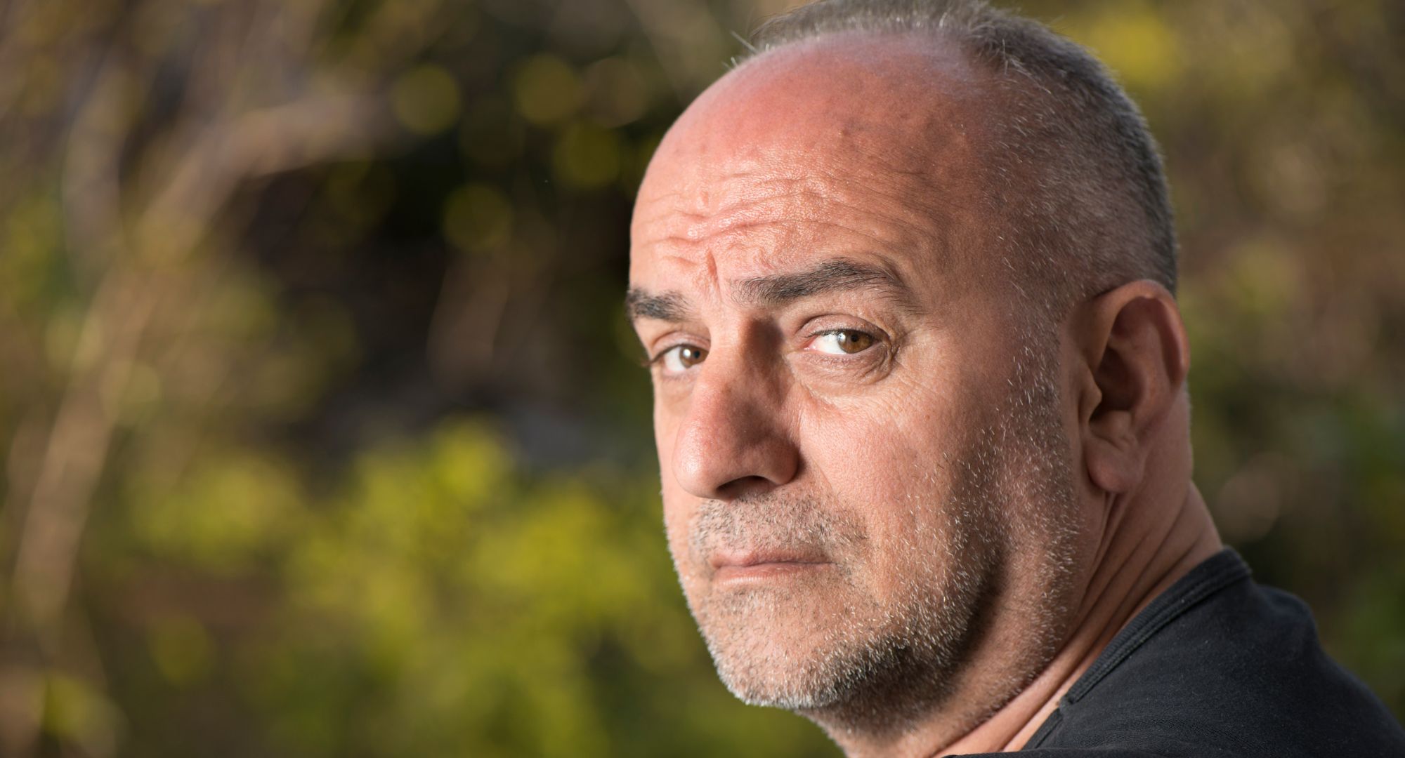 Hair loss in men
