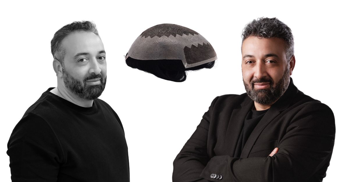 Permanent Cure For Baldness With Hairskeen