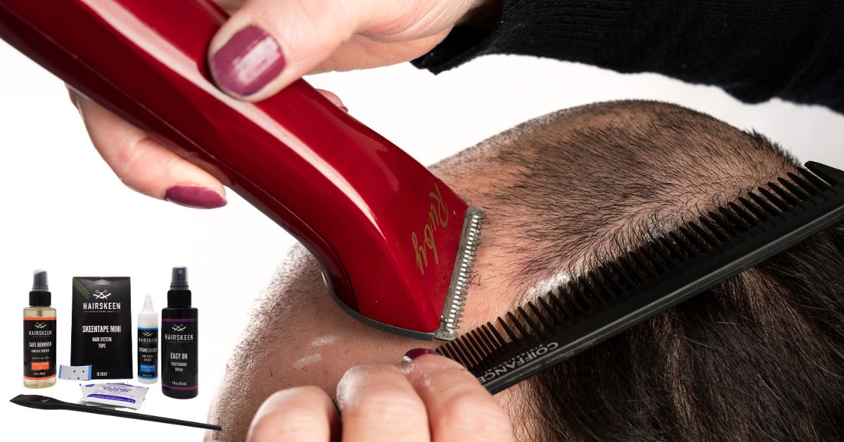 Experiencing Hair Loss