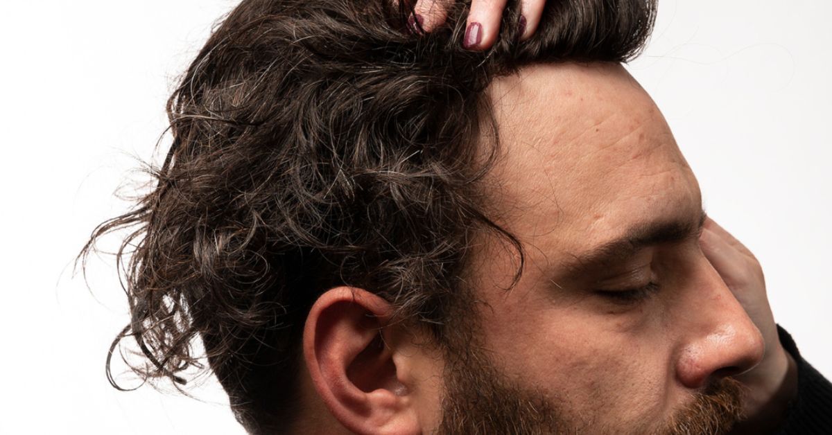 Embrace Comfort And Overcome Challenges With Hair Systems