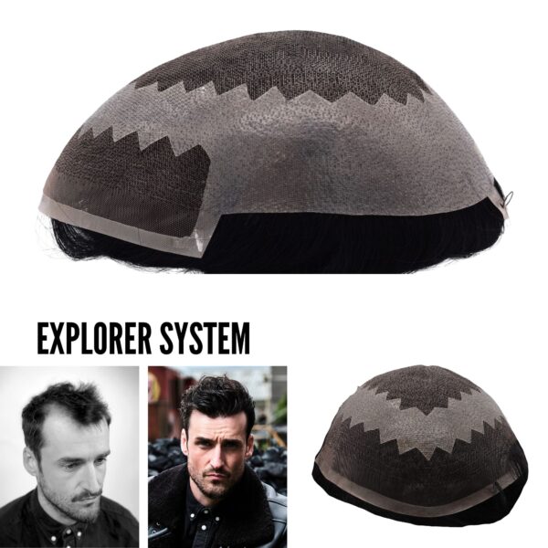 EXPLORER HAIR REPLACEMENT SYSTEM