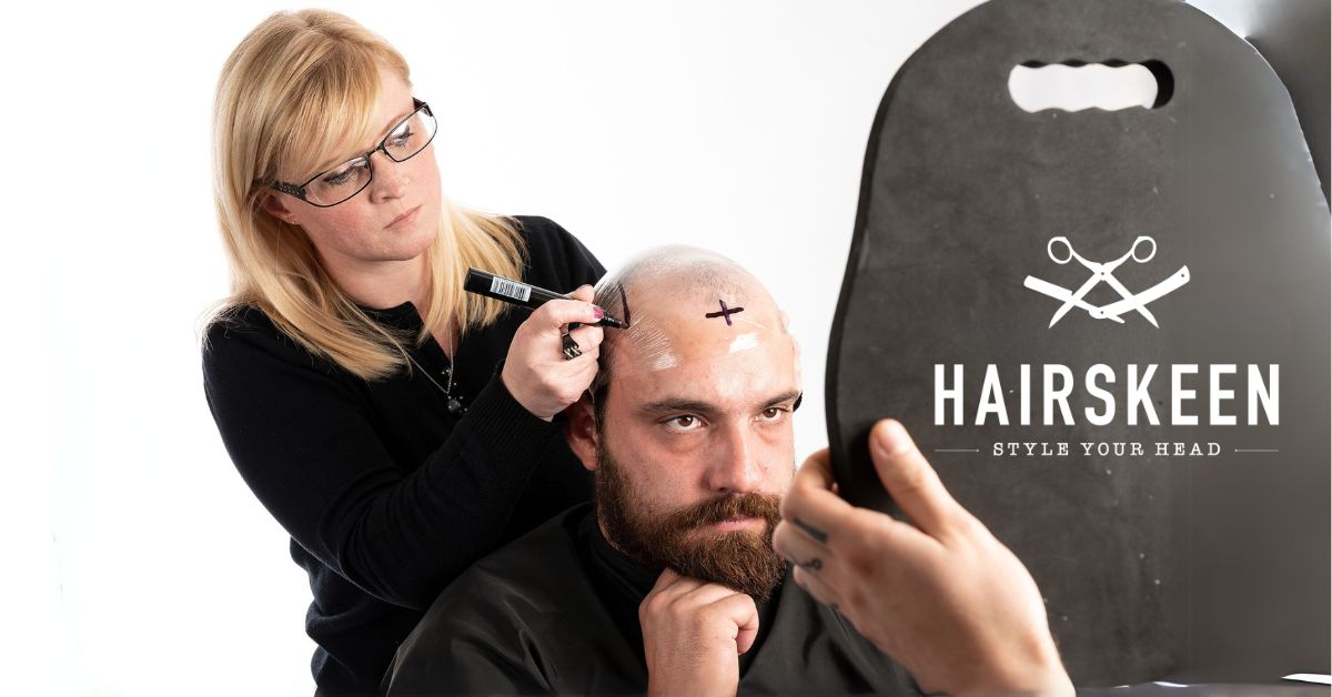 how hair loss affects self esteem, depression due to hair loss