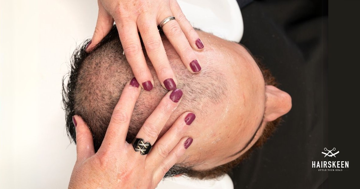 do hair systems damage scalp