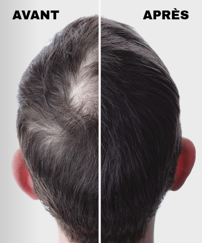 hairskeen fiber before-after