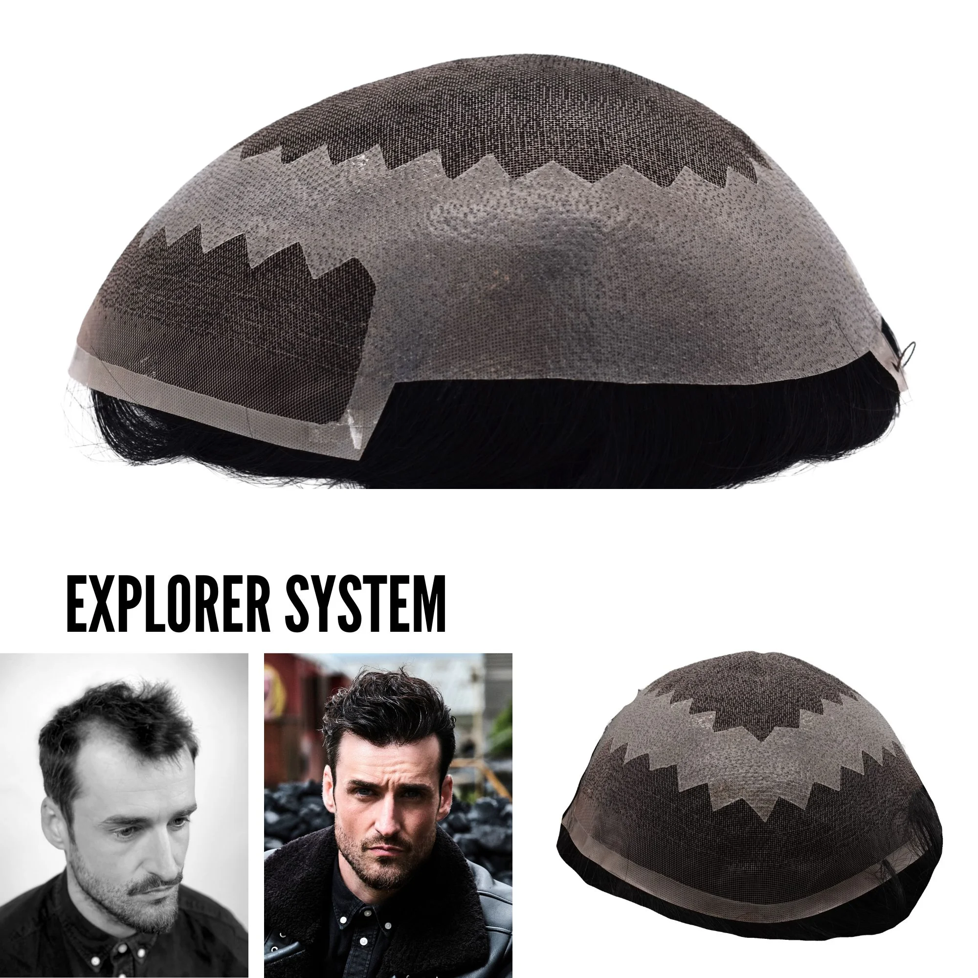 Hairskeen Explorer hair replacement system – product image