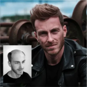 Confident man with full stylish hair and small before image showing hair loss – Hairskeen hair system transformation