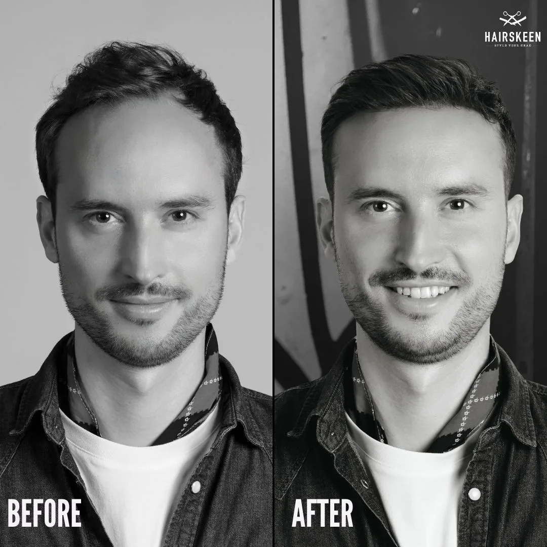Hairskeen Frontskeen-a (2”x5”) male frontal hair system – product image